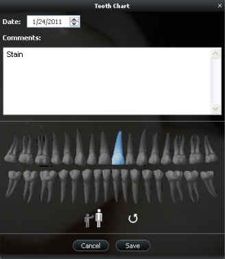 toothChart