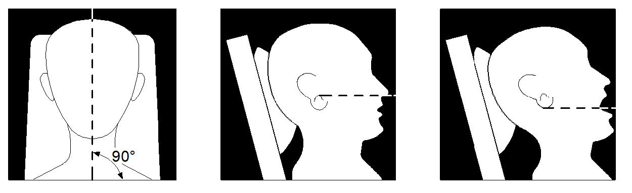 patient position
