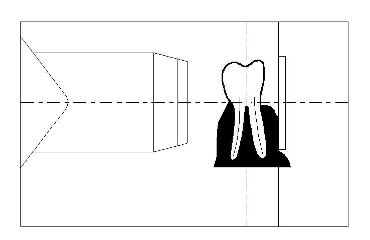 align the beam