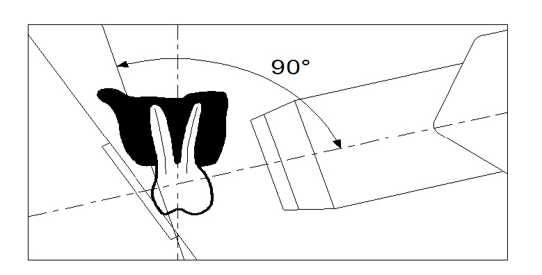 bisecting technique