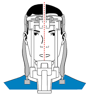 Positioning Diagram Temple Supports Maxillo Facial