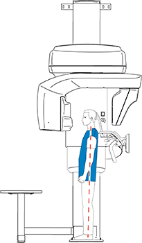 Patient Positioning for 3D Face Scan Images