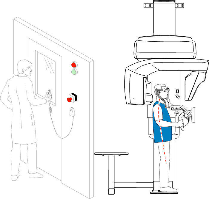 X-Ray Preparation