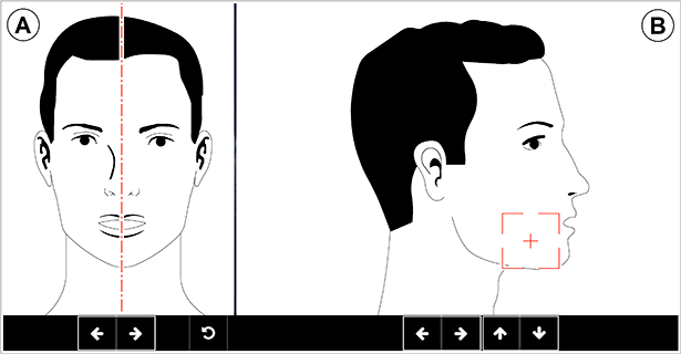 Diagram of Field of View positioning
