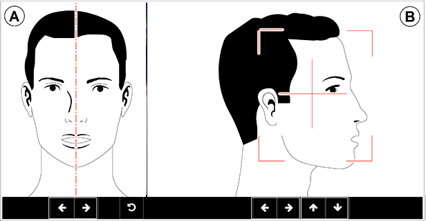Diagram of Field of View positioning