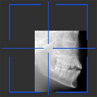 Scout View 2D Maxillo Facial