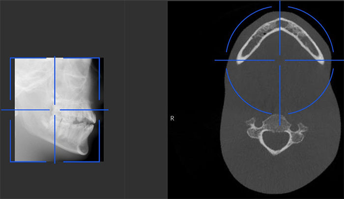Scout View3D Jaw