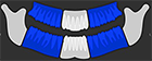 Segmented Bitewing Pano